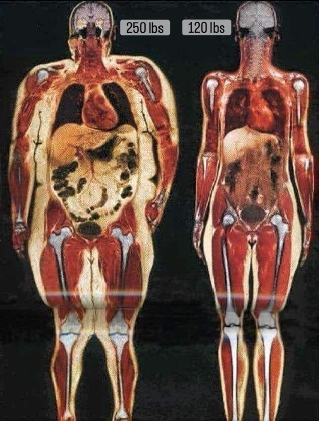 The Invisible Reality: What an MRI Reveals About Your Internal Health